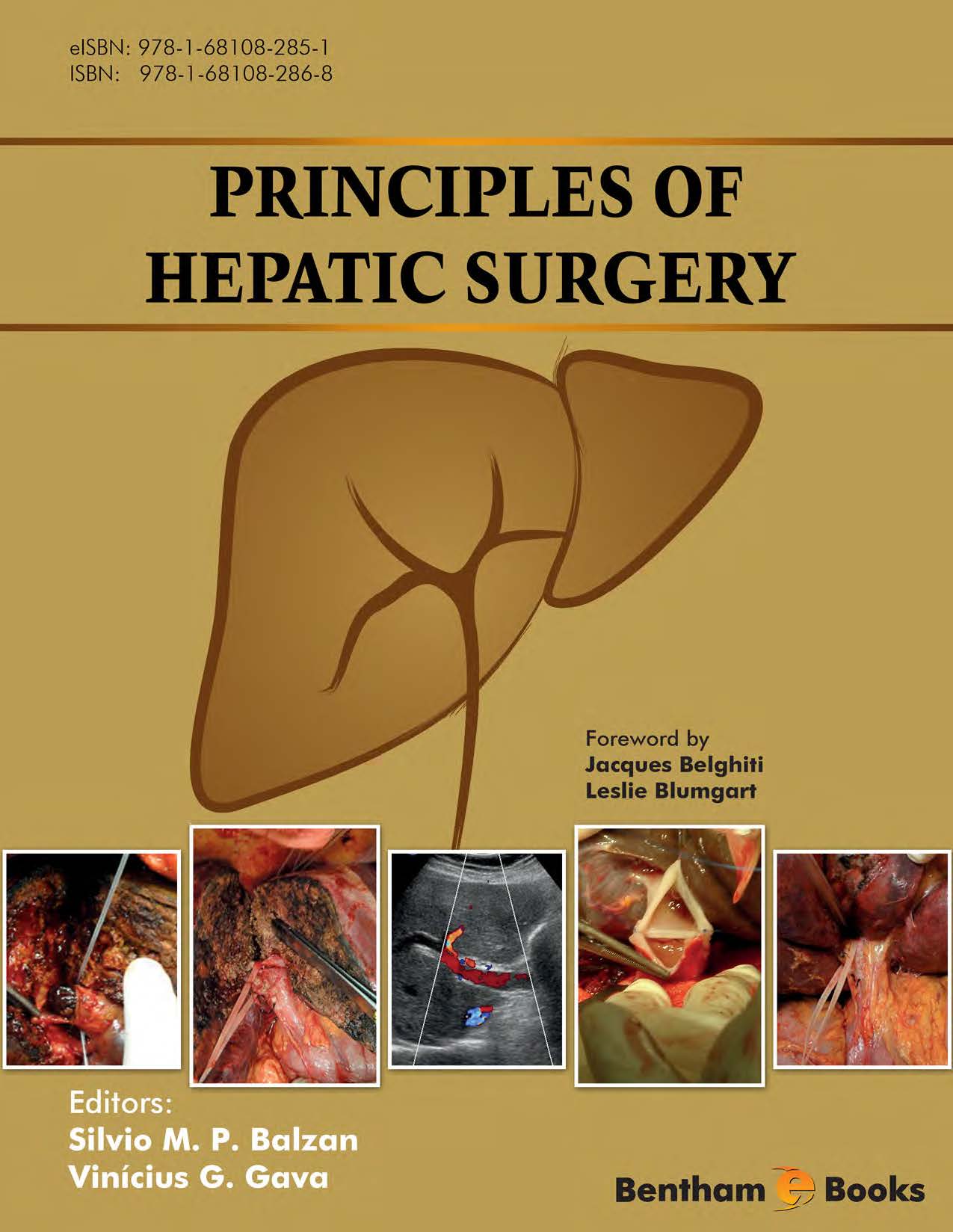 Principles of Hepatic Surgery Principles of Hepatic Surgery