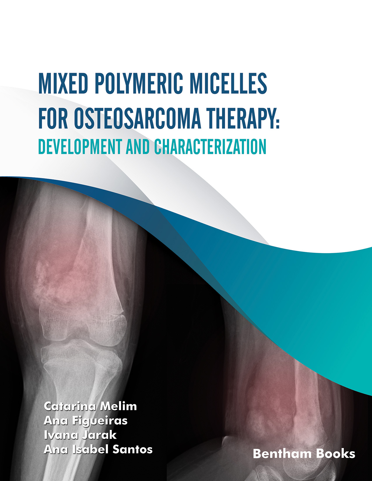 Mixed Polymeric Micelles for Osteosarcoma Therapy: Development and Characterization Mixed Polymeric Micelles for Osteosarcoma Therapy: Development and Characterization