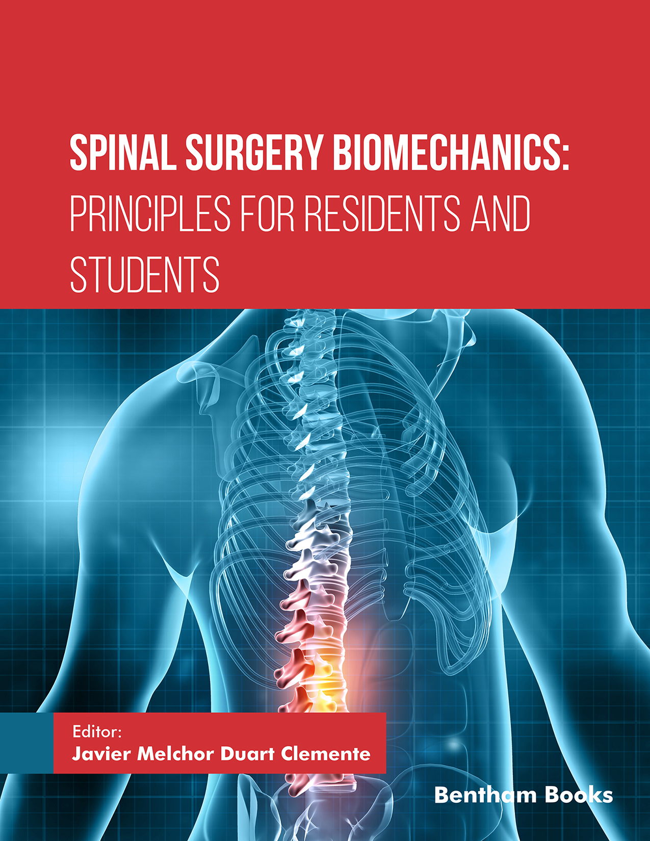 Spinal Surgery Biomechanics: Principles for Residents and Students