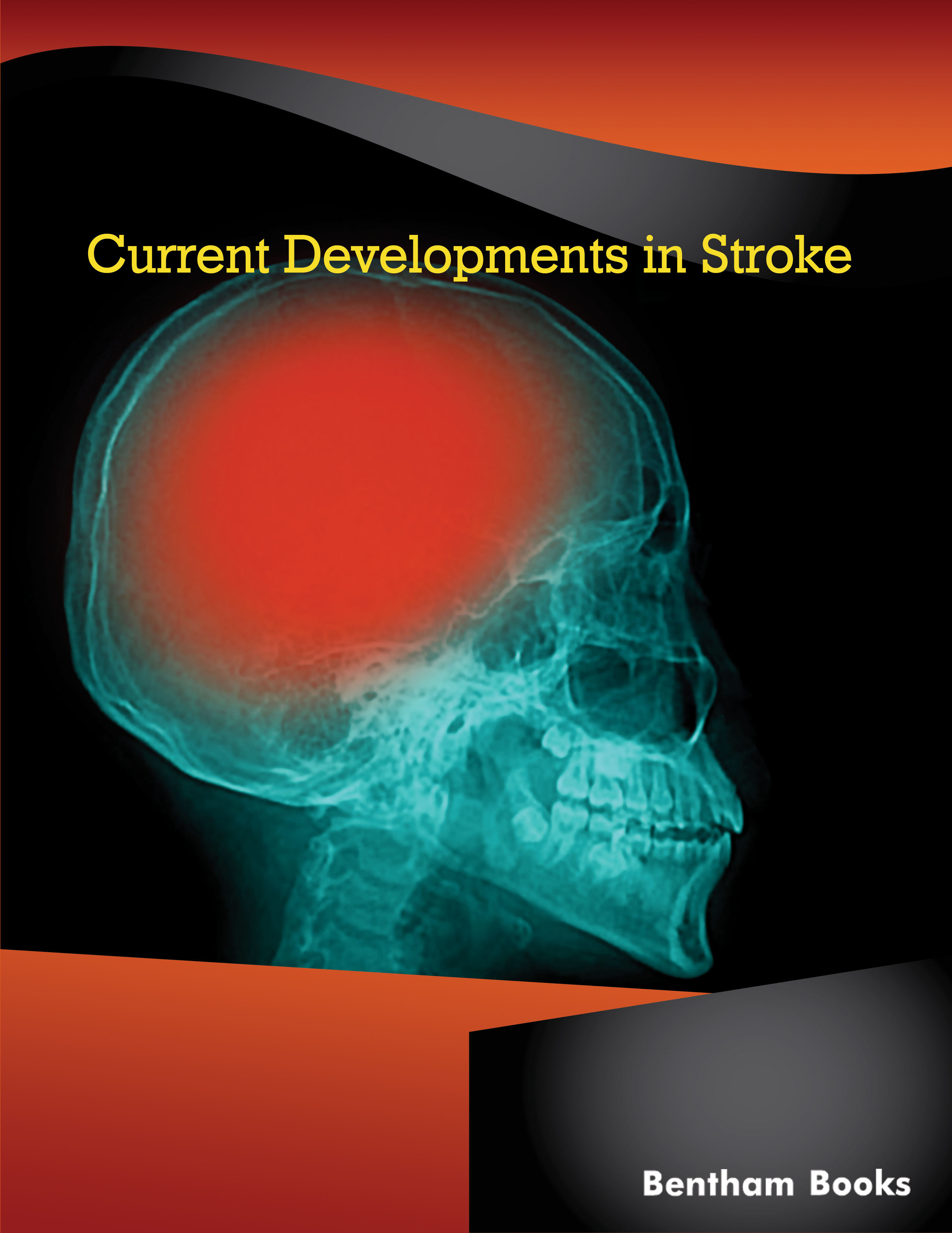 Current Developments in Stroke